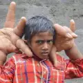 A Boy from India Astounds with his Unusual Hands