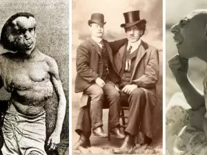 Circus Oddities Who Actually Existed