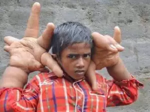 A Boy from India Astounds with his Unusual Hands