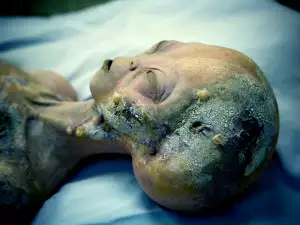 Autopsy of Extraterrestrial Admitted to be Real